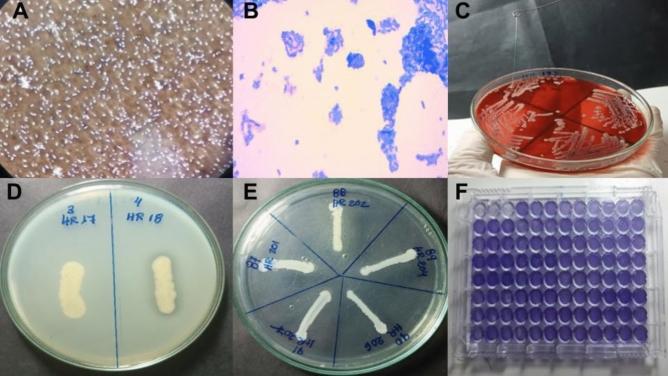 https://cdn.ncbi.nlm.nih.gov/pmc/blobs/4755/12037762/7bd5910482ab/41598_2025_97464_Fig2_HTML.jpg