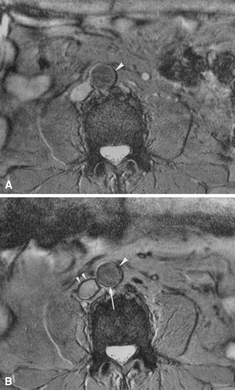 https://cdn.ncbi.nlm.nih.gov/pmc/blobs/475c/2940038/2b21c1f5e422/12350_2010_9263_Fig3_HTML.jpg