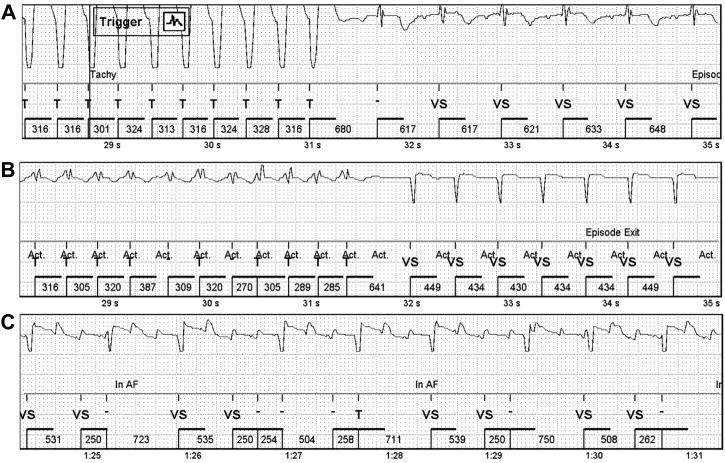 https://cdn.ncbi.nlm.nih.gov/pmc/blobs/4762/9039556/75acea362cba/gr3.jpg