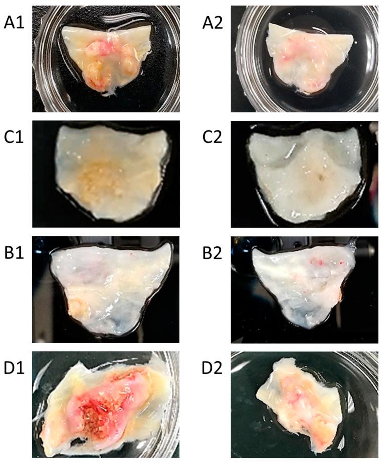 https://cdn.ncbi.nlm.nih.gov/pmc/blobs/4766/9405348/5451d5a6b48a/bioengineering-09-00393-g003.jpg