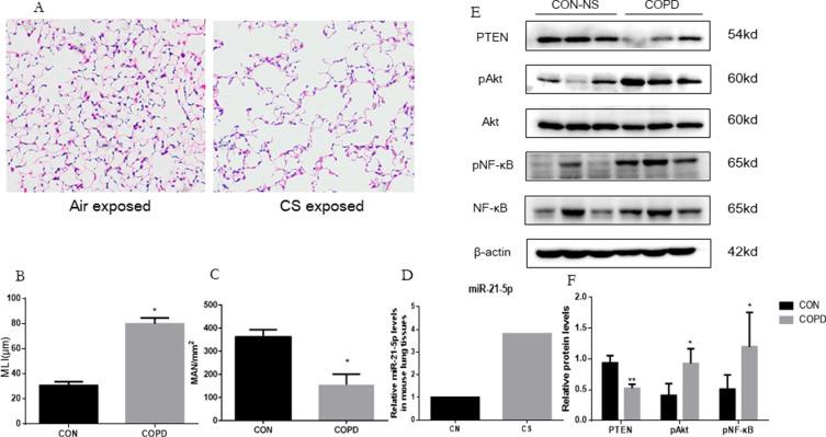 https://cdn.ncbi.nlm.nih.gov/pmc/blobs/4769/11137736/ae33d2f8d458/COPD-19-1141-g0003.jpg