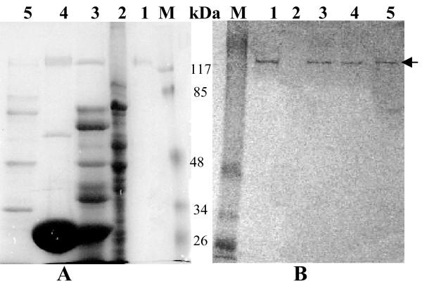 https://cdn.ncbi.nlm.nih.gov/pmc/blobs/4770/2927528/76e6077af8dd/1743-422X-7-181-3.jpg
