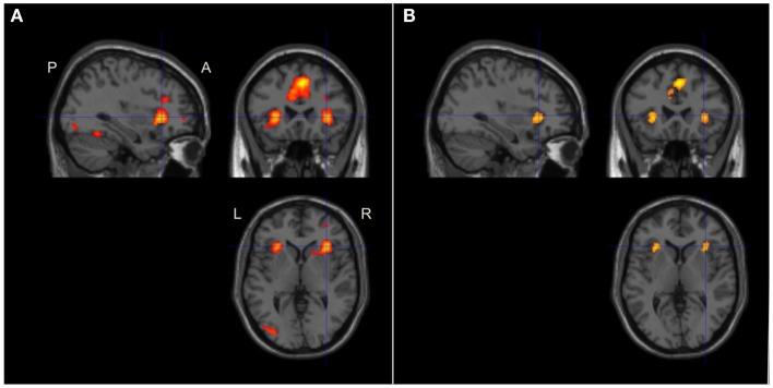 https://cdn.ncbi.nlm.nih.gov/pmc/blobs/4773/4306292/a1ed0bc93861/fnhum-08-01071-g006.jpg