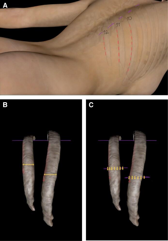 https://cdn.ncbi.nlm.nih.gov/pmc/blobs/4775/12378439/b5249c323f9f/ojaf044f2.jpg