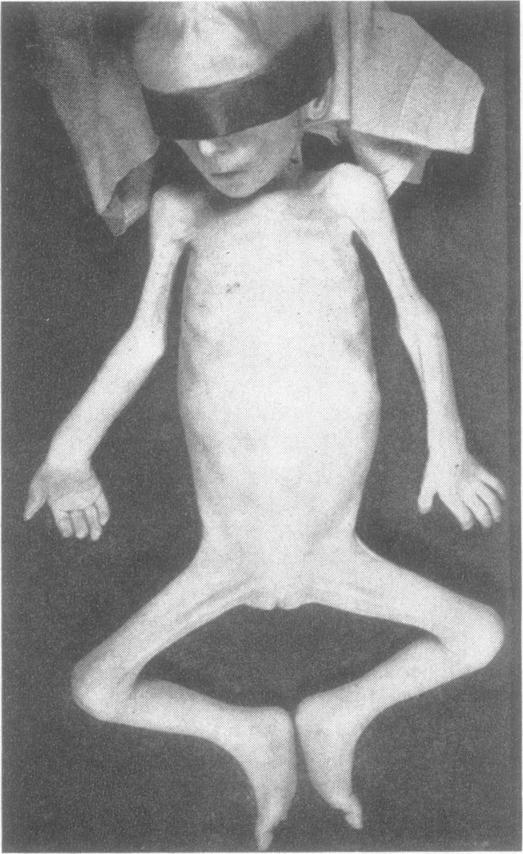https://cdn.ncbi.nlm.nih.gov/pmc/blobs/477c/495708/3edfb70d6c98/jnnpsyc00254-0048-a.jpg