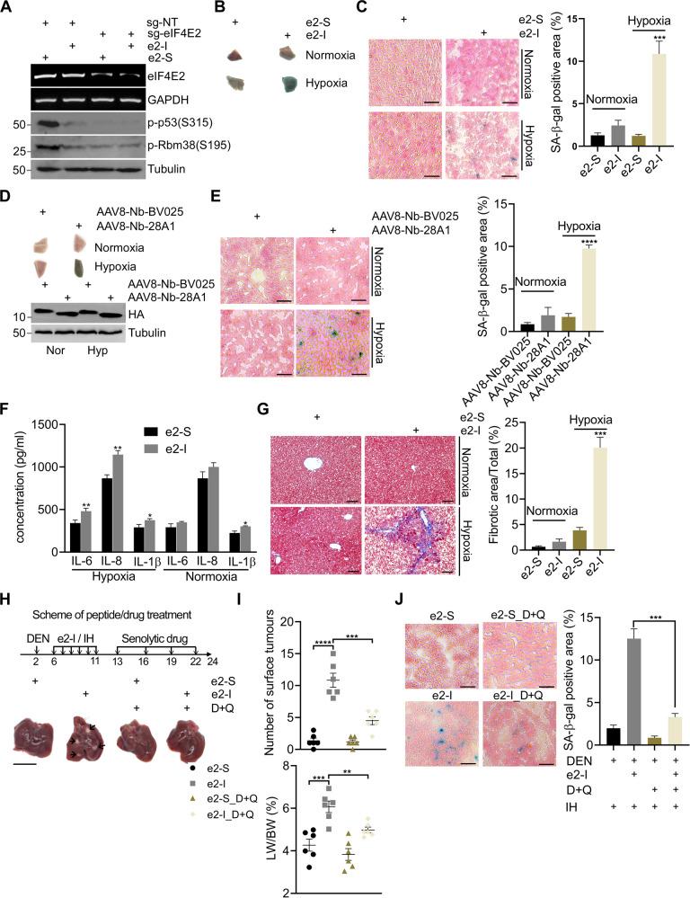 https://cdn.ncbi.nlm.nih.gov/pmc/blobs/477d/9107480/abe49716fb4e/41419_2022_4897_Fig5_HTML.jpg
