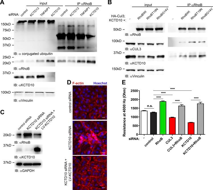 https://cdn.ncbi.nlm.nih.gov/pmc/blobs/4783/5839774/5a757010cb85/JCB_201606055_Fig8.jpg