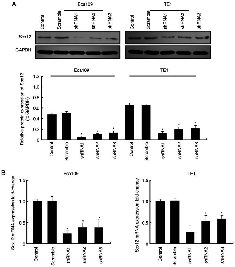 https://cdn.ncbi.nlm.nih.gov/pmc/blobs/4786/7709828/298430cc0a24/OR-45-01-0129-g01.jpg