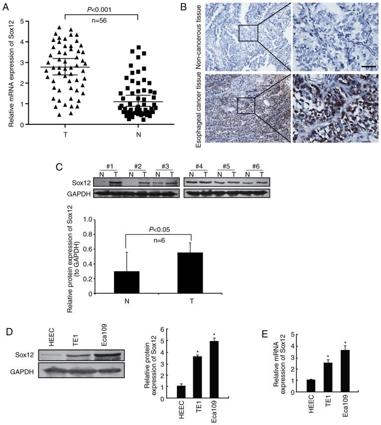https://cdn.ncbi.nlm.nih.gov/pmc/blobs/4786/7709828/4b19c24b5fbd/OR-45-01-0129-g00.jpg