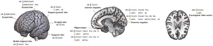 https://cdn.ncbi.nlm.nih.gov/pmc/blobs/4788/8569809/351c1e8ffd1a/fnagi-13-738971-g0009.jpg