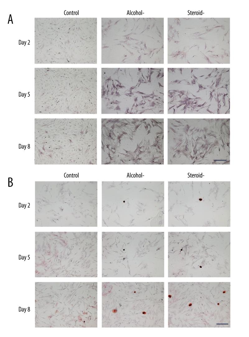 https://cdn.ncbi.nlm.nih.gov/pmc/blobs/478f/5797332/a88ddf657011/medscimonit-24-539-g006.jpg