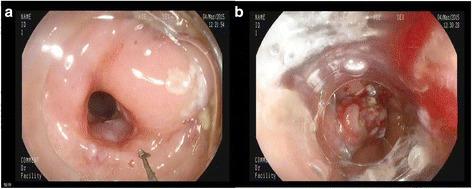 https://cdn.ncbi.nlm.nih.gov/pmc/blobs/4798/4717638/912daaef0ffa/12876_2016_420_Fig3_HTML.jpg