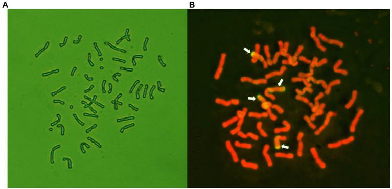 https://cdn.ncbi.nlm.nih.gov/pmc/blobs/4798/8215663/e6bfee423283/fpls-12-689502-g002.jpg