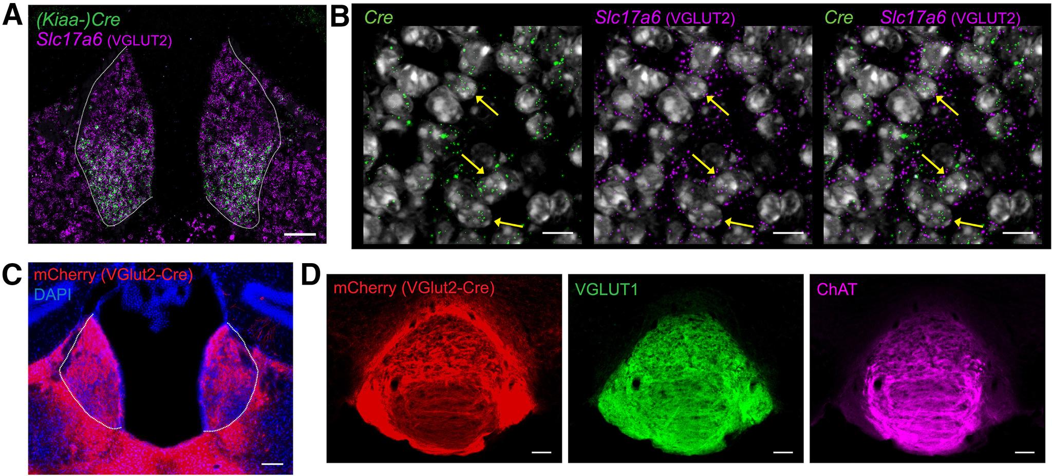 https://cdn.ncbi.nlm.nih.gov/pmc/blobs/479b/8751853/592206e88dad/ENEURO.0481-21.2021_f003.jpg