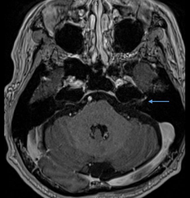 https://cdn.ncbi.nlm.nih.gov/pmc/blobs/479d/9978074/470e5d5bc08e/IJU5-6-144-g001.jpg