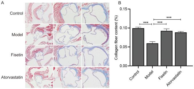 https://cdn.ncbi.nlm.nih.gov/pmc/blobs/479e/7690243/113a57759693/etm-21-01-09457-g02.jpg