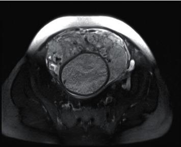 https://cdn.ncbi.nlm.nih.gov/pmc/blobs/47a0/9050272/b8569755a428/CMMM2022-7546201.003.jpg