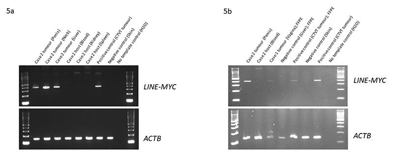 https://cdn.ncbi.nlm.nih.gov/pmc/blobs/47a2/7615759/59ac47aae30a/EMS194721-f005.jpg