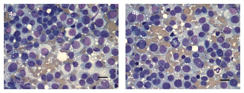https://cdn.ncbi.nlm.nih.gov/pmc/blobs/47a2/7615759/d3aa582926a6/EMS194721-f004.jpg