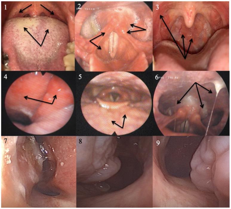 https://cdn.ncbi.nlm.nih.gov/pmc/blobs/47aa/10671871/1b6fd460aea8/jpm-13-01567-g004.jpg