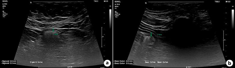 https://cdn.ncbi.nlm.nih.gov/pmc/blobs/47aa/11666260/681b417b9457/crg-2025-0019-0001-542711_F04.jpg