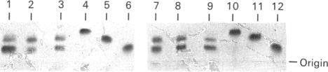 https://cdn.ncbi.nlm.nih.gov/pmc/blobs/47af/1150014/c02676a6d86e/biochemj00162-0076-a.jpg