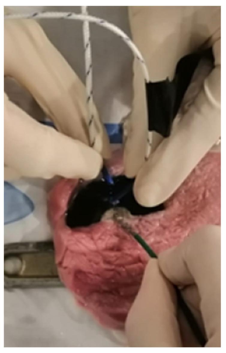 https://cdn.ncbi.nlm.nih.gov/pmc/blobs/47b5/11048352/726a33d7e363/biomedicines-12-00869-g003.jpg