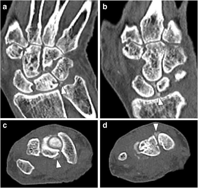 https://cdn.ncbi.nlm.nih.gov/pmc/blobs/47b7/8189950/019c6bfbddcd/256_2020_3580_Fig1_HTML.jpg