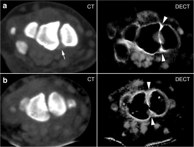 https://cdn.ncbi.nlm.nih.gov/pmc/blobs/47b7/8189950/c6a5c844db06/256_2020_3580_Fig4_HTML.jpg