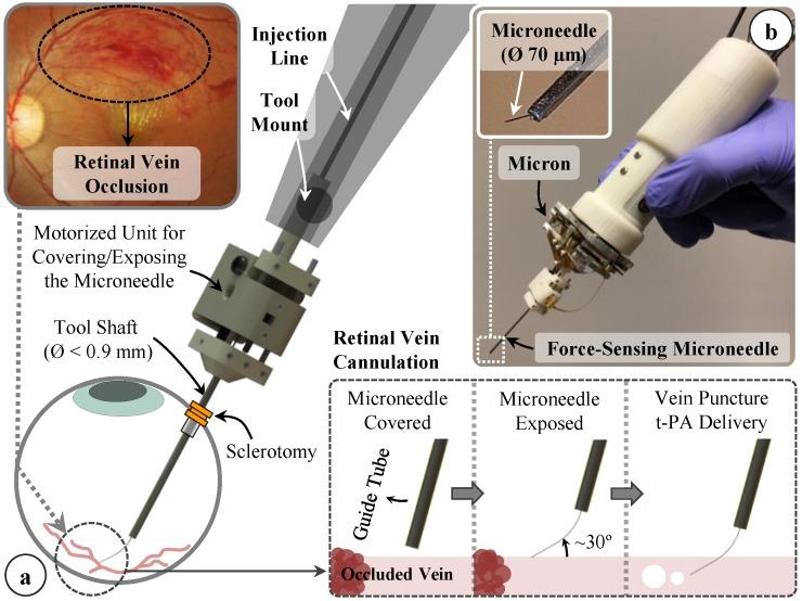https://cdn.ncbi.nlm.nih.gov/pmc/blobs/47ba/5677255/f1baea431e77/sensors-17-02195-g001.jpg