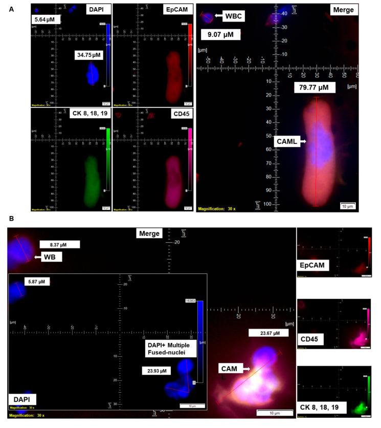 https://cdn.ncbi.nlm.nih.gov/pmc/blobs/47bc/9558552/418795a7f08a/cancers-14-04577-g003a.jpg