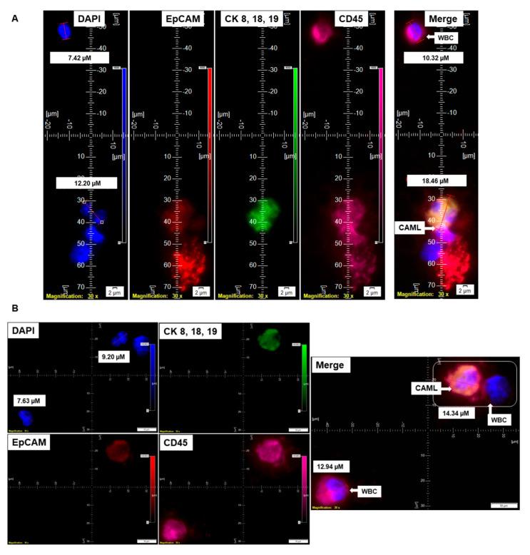 https://cdn.ncbi.nlm.nih.gov/pmc/blobs/47bc/9558552/a585c69a8d27/cancers-14-04577-g004a.jpg