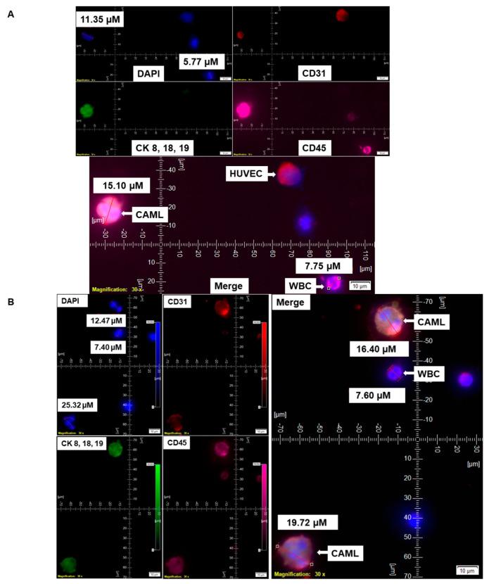 https://cdn.ncbi.nlm.nih.gov/pmc/blobs/47bc/9558552/ada9301056ce/cancers-14-04577-g002.jpg