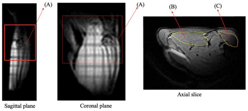https://cdn.ncbi.nlm.nih.gov/pmc/blobs/47c4/8064087/60f8eda038d3/diagnostics-11-00586-g004.jpg