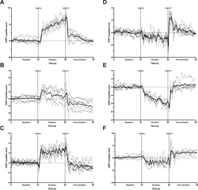 https://cdn.ncbi.nlm.nih.gov/pmc/blobs/47c7/9870114/e211800cfcc4/pone.0280835.g002.jpg