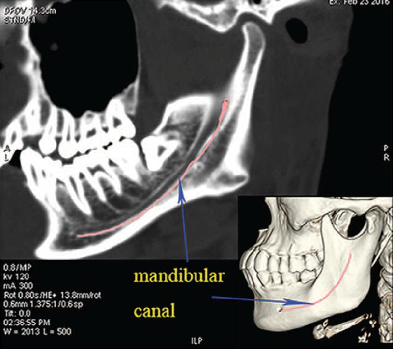 https://cdn.ncbi.nlm.nih.gov/pmc/blobs/47c8/7581044/e01f6f858d8a/medi-99-e22779-g001.jpg
