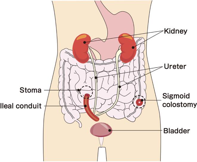https://cdn.ncbi.nlm.nih.gov/pmc/blobs/47cc/10558673/632af9406d78/CCR3-11-e8019-g001.jpg