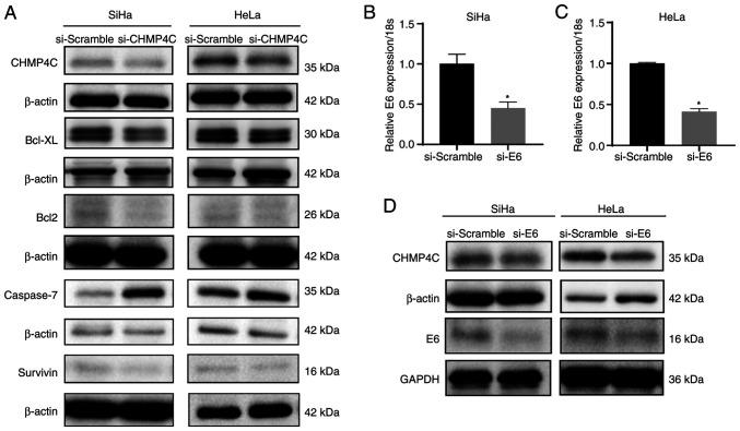 https://cdn.ncbi.nlm.nih.gov/pmc/blobs/47cc/12005071/92e56e9fd907/ol-29-06-15021-g05.jpg