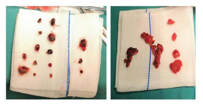https://cdn.ncbi.nlm.nih.gov/pmc/blobs/47d1/12319075/1973180ef63e/41598_2025_14219_Fig2_HTML.jpg