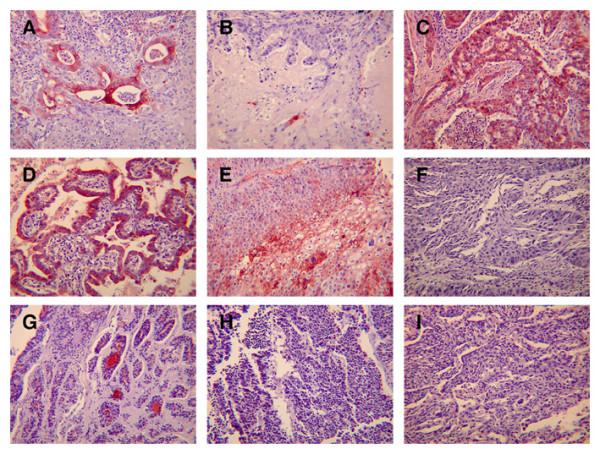 https://cdn.ncbi.nlm.nih.gov/pmc/blobs/47d2/1459147/a67e7cd3479d/1465-9921-7-61-5.jpg