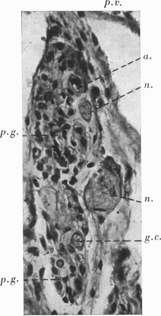 https://cdn.ncbi.nlm.nih.gov/pmc/blobs/47d5/1252785/29d25d9f2380/janat00530-0104-d.jpg