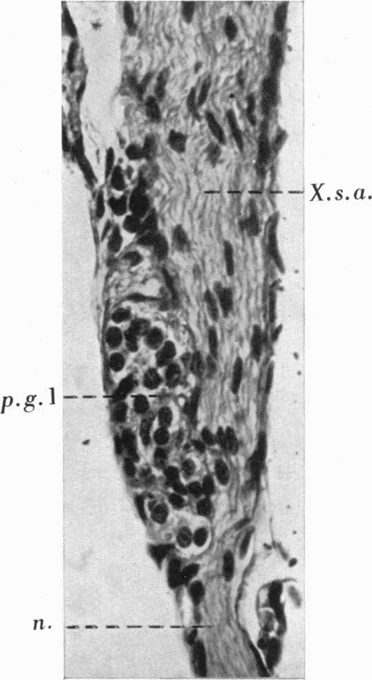 https://cdn.ncbi.nlm.nih.gov/pmc/blobs/47d5/1252785/bc7e7458f197/janat00530-0103-d.jpg