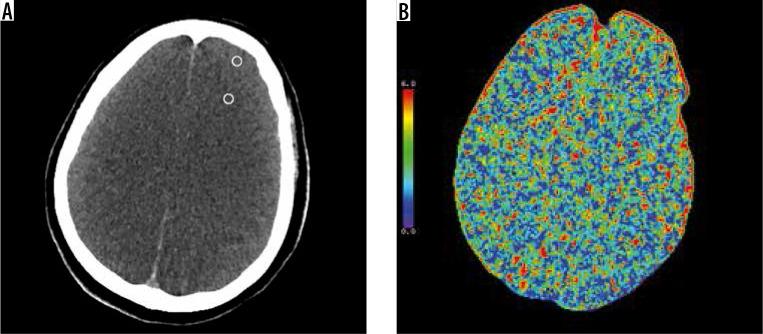 https://cdn.ncbi.nlm.nih.gov/pmc/blobs/47db/7757508/6e5786c43964/PJR-85-42608-g004.jpg