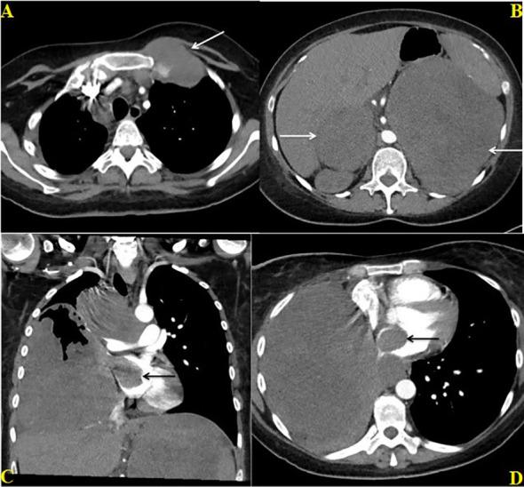 https://cdn.ncbi.nlm.nih.gov/pmc/blobs/47db/9902933/5e4039088468/fonc-13-1117024-g002.jpg