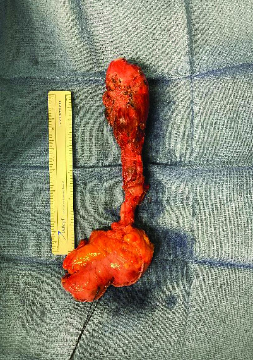https://cdn.ncbi.nlm.nih.gov/pmc/blobs/47dd/10291394/524139b5b584/mmt-09-63-g4.jpg
