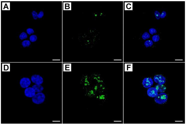 https://cdn.ncbi.nlm.nih.gov/pmc/blobs/47dd/5983851/1cffb1502c5f/ijms-19-01478-g002.jpg