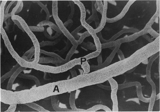 https://cdn.ncbi.nlm.nih.gov/pmc/blobs/47de/1167497/a05c7402a0be/janat00128-0177-a.jpg