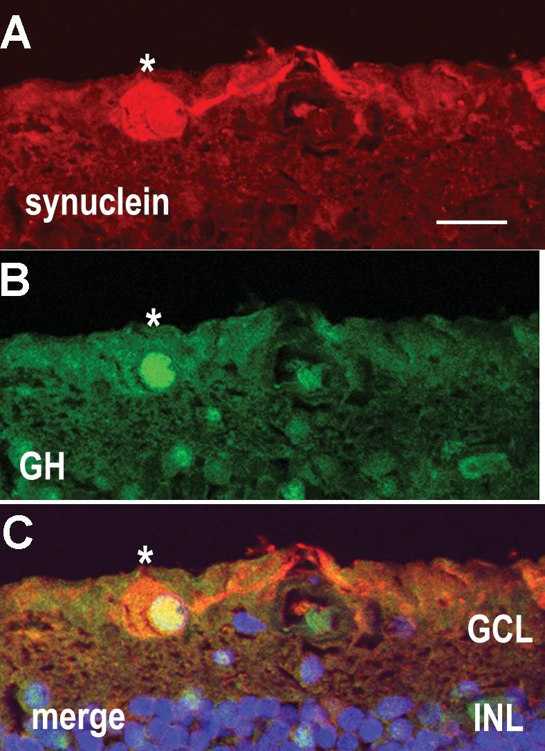 https://cdn.ncbi.nlm.nih.gov/pmc/blobs/47e0/2676198/c8199953a0a3/mv-v15-920-f3.jpg