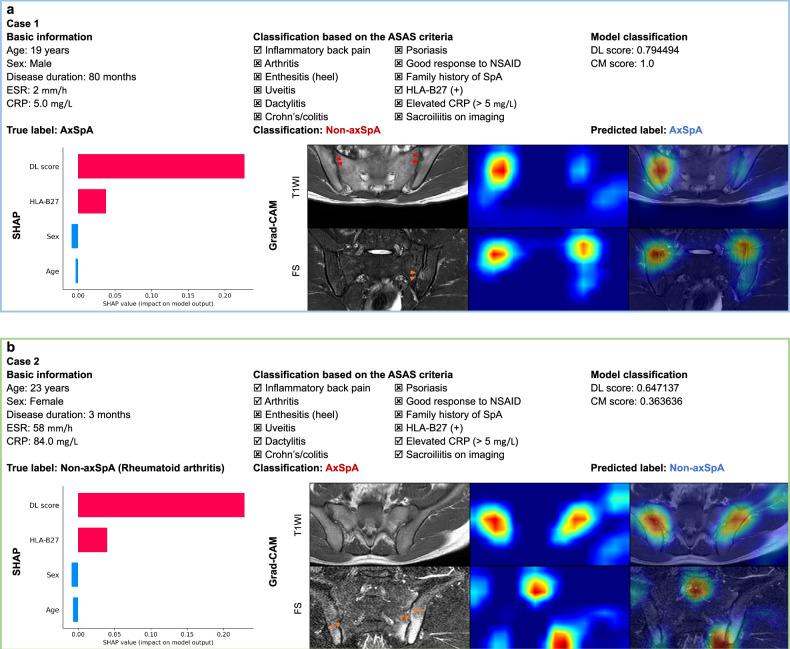 https://cdn.ncbi.nlm.nih.gov/pmc/blobs/47e1/12031678/bbce69f9bdaf/13244_2025_1967_Fig6_HTML.jpg