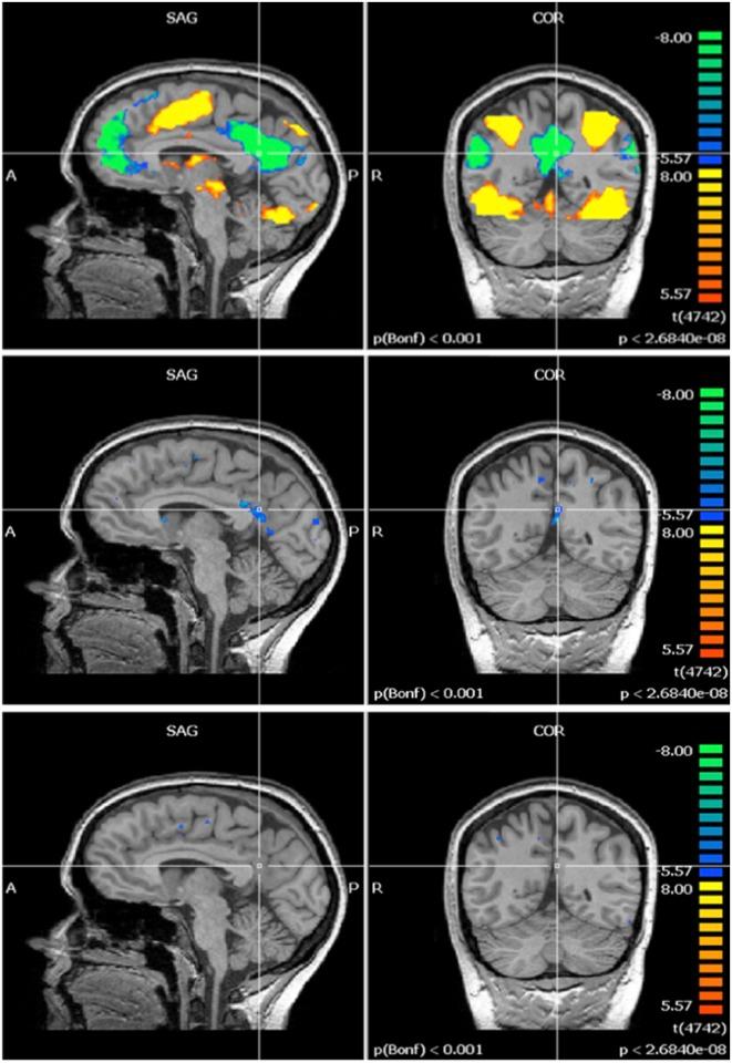 https://cdn.ncbi.nlm.nih.gov/pmc/blobs/47e1/4516358/07d31f6eef20/pone.0132024.g009.jpg